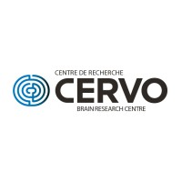 CERVO Brain research centre